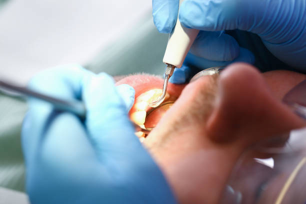 Best Broken or Cracked Tooth Emergency Dentist in Woodhaven, MI