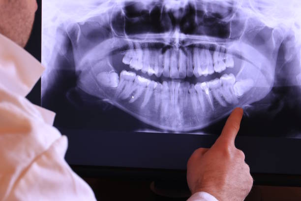 Best Emergency Root Canal Treatment in Woodhaven, MI