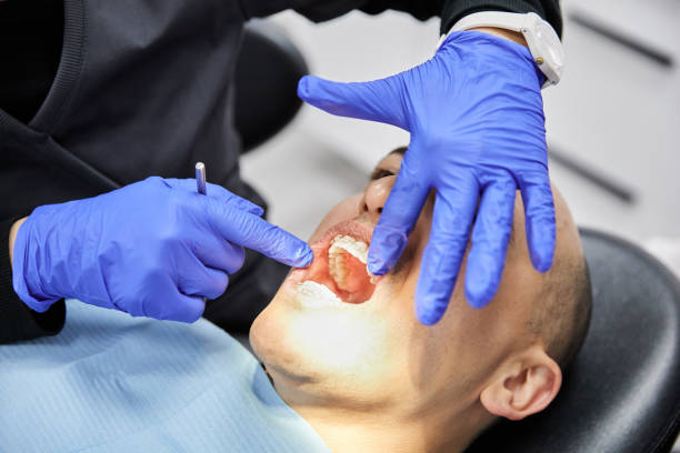 Best Emergency Dentist for Knocked-Out Tooth in Woodhaven, MI