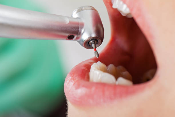Best Emergency Dental Services for Seniors in Woodhaven, MI